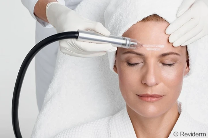 Microdermabrasion